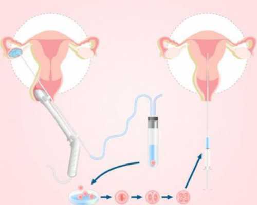 北京专业供卵自怀,北京正规捐卵,北京市正规捐卵