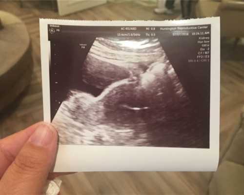 2025衢州人民医院试管婴儿导航，费用明细表及成功率公布