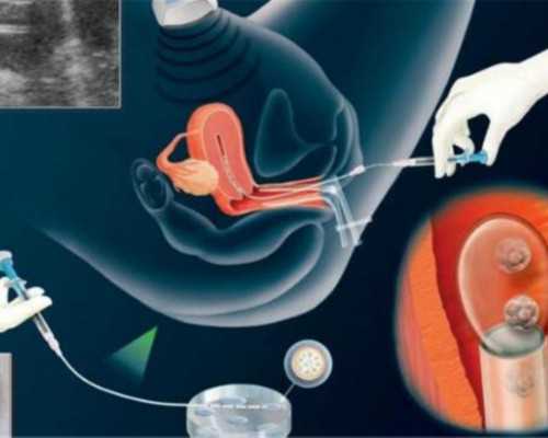 北京代孕哪里做最好,北京哪家医院试管婴儿,北京治疗试管婴儿哪家医院好