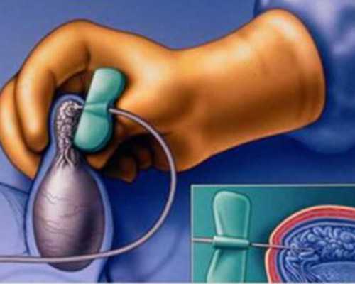 北京医院代孕费用多少,北京私立医院做试管,北京哪家私立医院试管做的好 北京医院代孕费用多少,北京私立医院做试管,北京哪家私立医院试管做的好