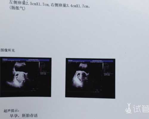 北京有代怀网站吗,北京家恩德运医院做试管多少钱?附北京家恩德运医院介绍