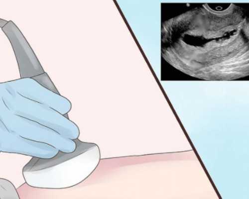 北京代生小孩价格,北京协和医院试管婴儿挂号,北京协和医院第三代试管婴儿