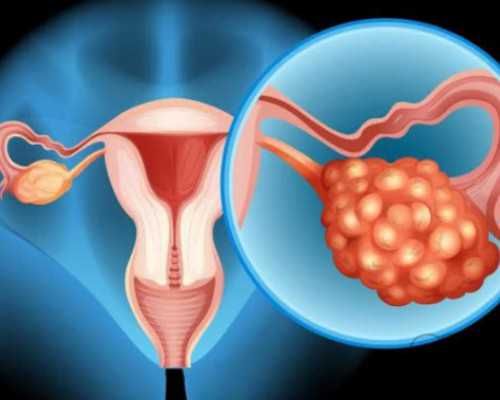 北京代孕哪家做的好,北京治疗卵巢早衰的医生,北京卵巢早衰的手术治疗 北京代孕哪家做的好,北京治疗卵巢早衰的医生,北京卵巢早衰的手术治疗