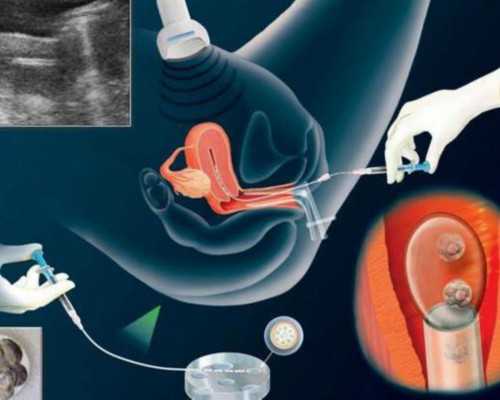 北京供卵试管咨询,北京供卵都来李广