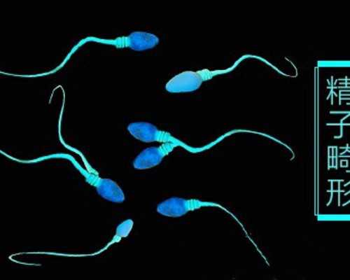 北京正规试管代孕公司,北京治疗无精的医院那好,北京治疗无精症的医院哪家好