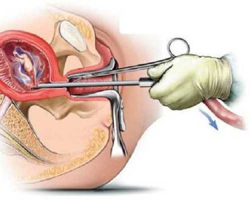 北京供卵试管医院,2025北京试管医院有卵子库吗？附北京16家供卵医院名单分享